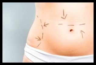 CIRUGIA ABDOMEN