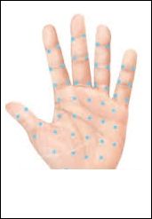 HIPERHIDROSIS PAMAR EDI