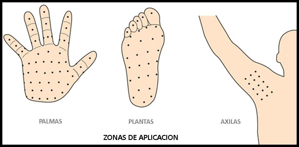 Zonas de aplicacin