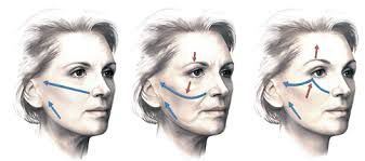cirugia endoscopica facial